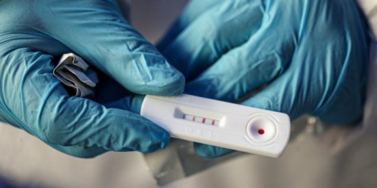 ΕΚΠΑ: Πόσο αξιόπιστα είναι τα rapid test για τον κορονοϊό